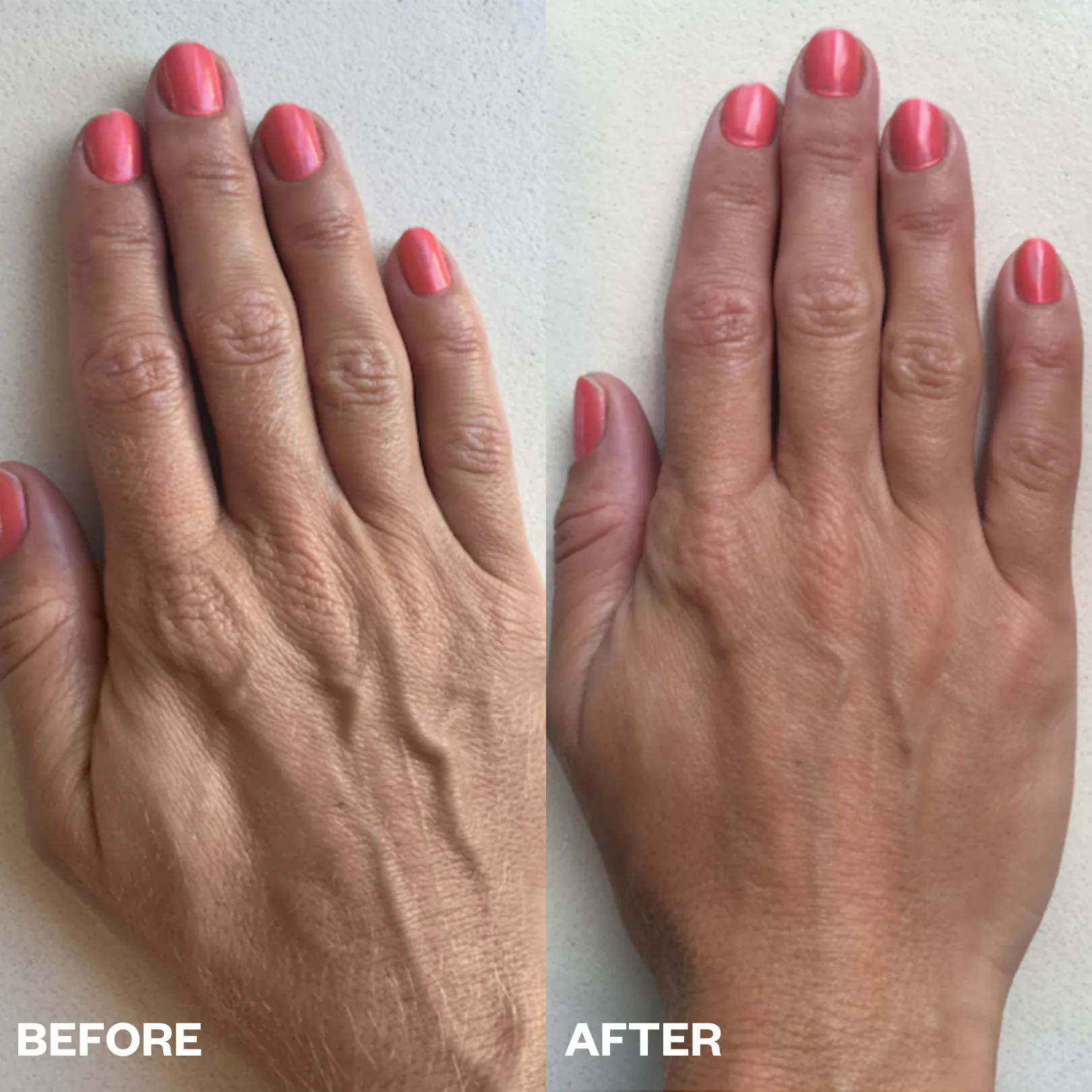 Hand Smoothing Kit