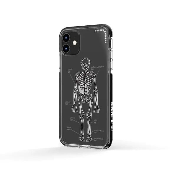 iPhone Case - About Me